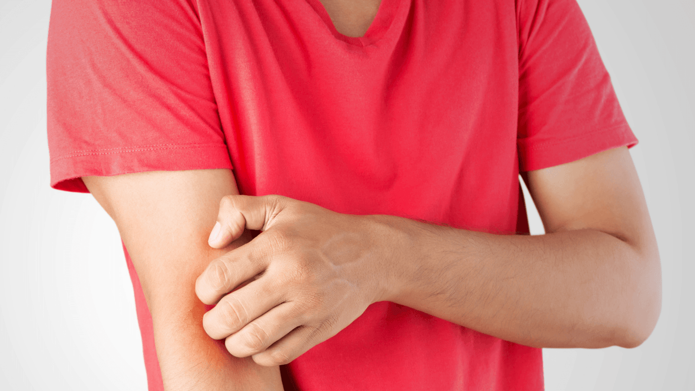 Ringworm: Causes, Symptoms, Treatment, and Prevention - Spar Soap | Natural Soap for Combat Athletes